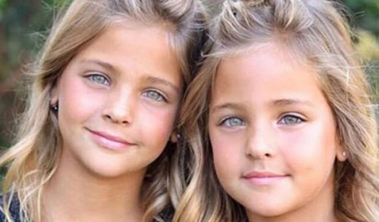 « Les plus belles jumelles du monde » ont déjà 12 ans : Que sont-elles devenues aujourd’hui ?