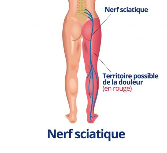 Si Vous Souffrez De La Sciatique Un Petit Exercice Vous Aidera Vous