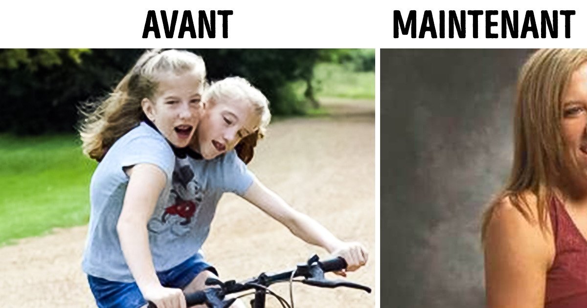 Les sœurs siamoises Brittany et Abby Hensel ont maintenant 32 ans et leur vie a bien changé