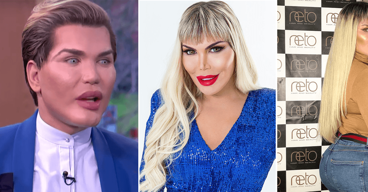 Rodrigo Alves, le Ken humain, est à présent une femme