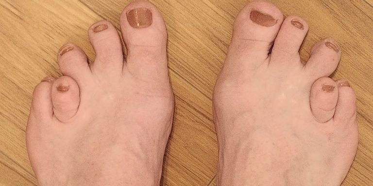 Les 15 Pieds Les Plus Moches Au Monde En Images
