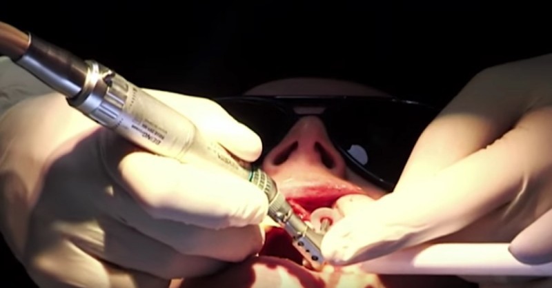 chirurgie dentaire de Gemma Swift retransmis en direct à la télévision