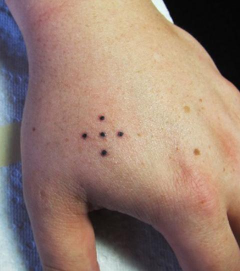 Un tatouage composé de 5 points noirs entre l'index et le pouce.