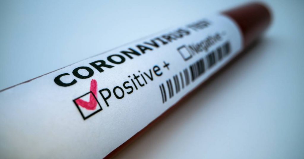 Un test positif au coronavirus.