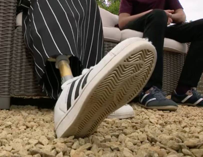 Covid19 Elia, 18 ans, a été amputée de la jambe suite au virus un