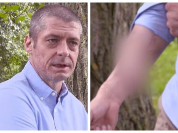 Malcolm montrant son phallus greffé sur son bras.