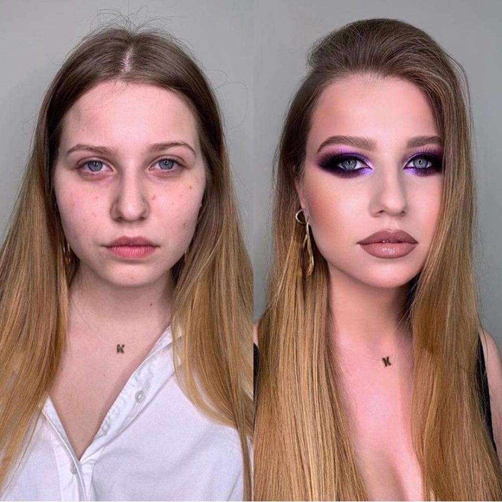 Une jeune femme cache ses boutons avec le maquillage.