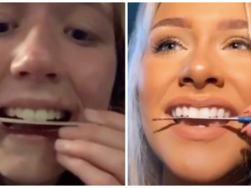 Se limer les dents : la nouvelle tendance TikTok.