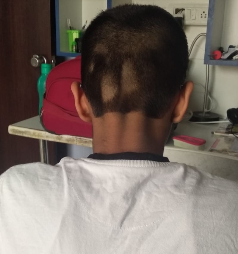 L'arrière d'une coupe de cheveux complètement ratée avec des trous 