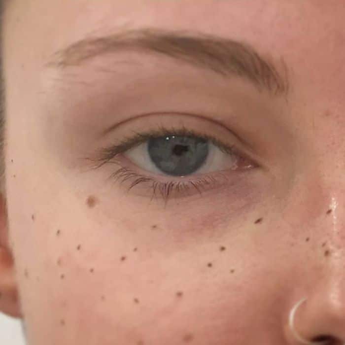 tatouage freckling taches de rousseur
