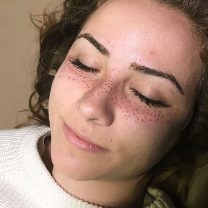 tatouage freckling taches de rousseur