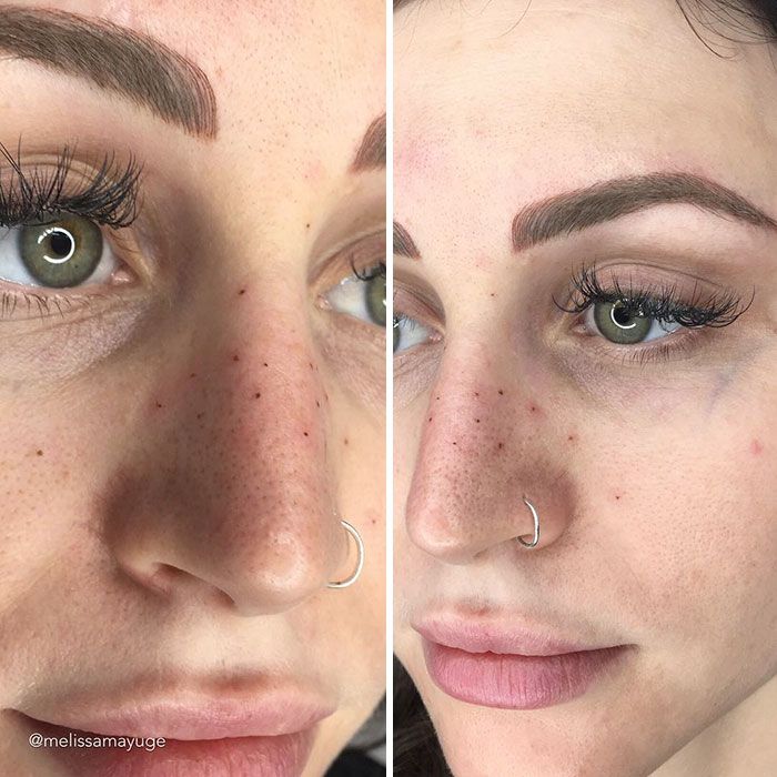 tatouage freckling taches de rousseur
