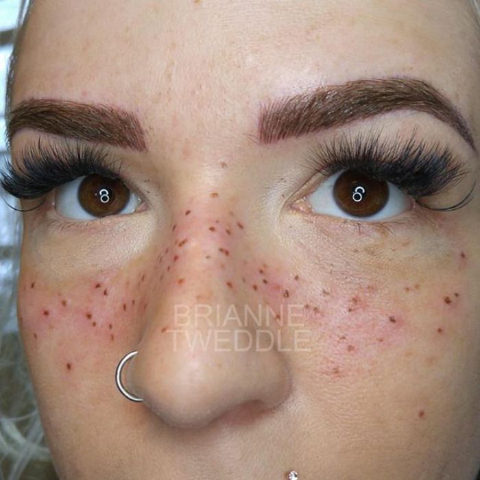 tatouage freckling taches de rousseur