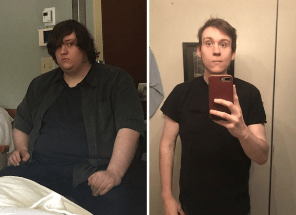 un ancien obèse qui a perdu du poids