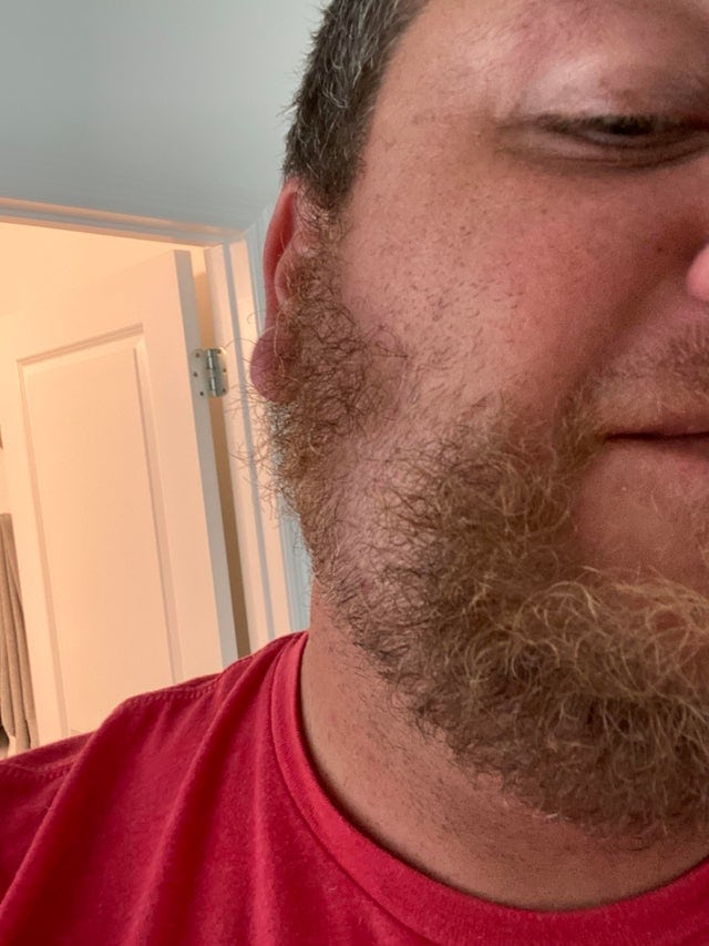 une barbe mal rasée