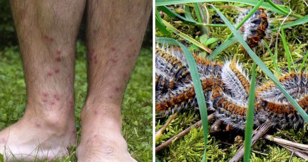 Démangeaisons, allergies, boutons les chenilles processionnaires et