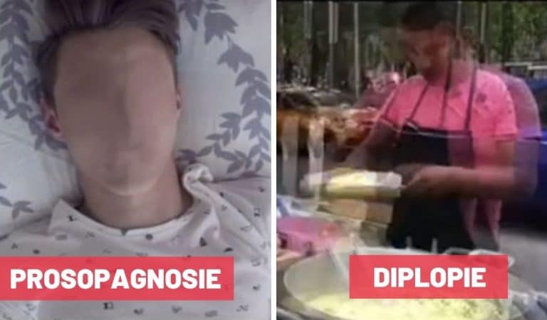 23 images qui montrent comment les personnes atteintes de pathologies visuelles voient le monde