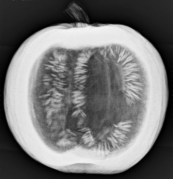 la radiographie d'une citrouille