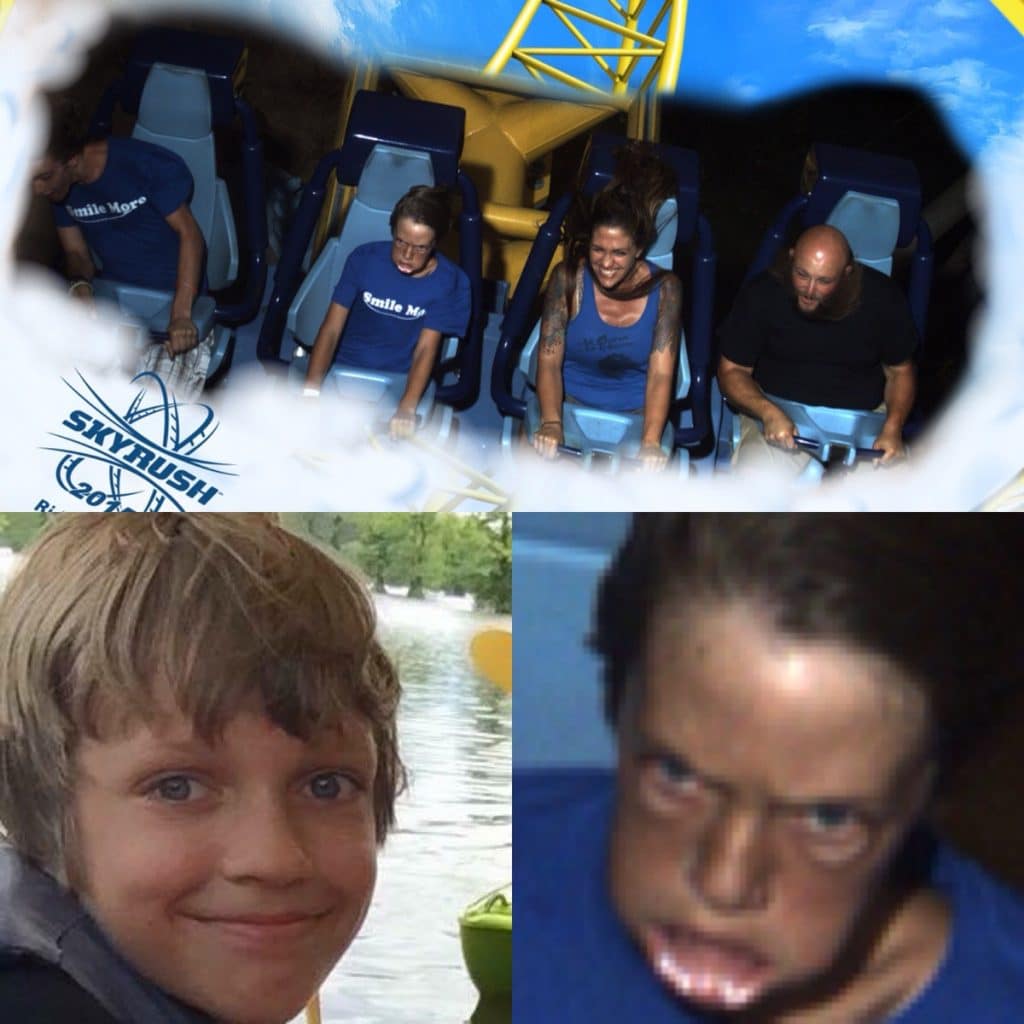Avant-après