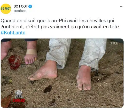 Les pieds difformes de Jean-Philippe