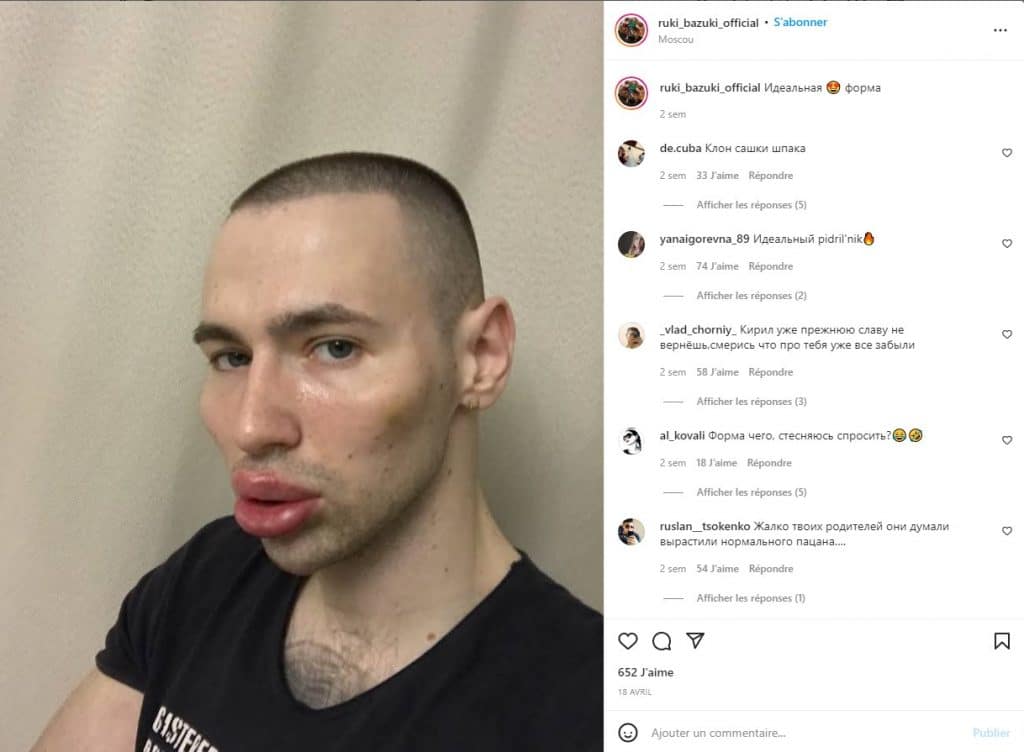 Chirurgie du visage de Kirill Tereshin croit en l'existence des extraterrestres et poursuit leur piste