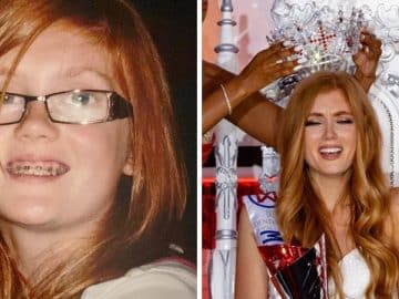 Frappée, crachée et brûlée en raison de sa différence, elle en fait sa force et devient Miss Angleterre