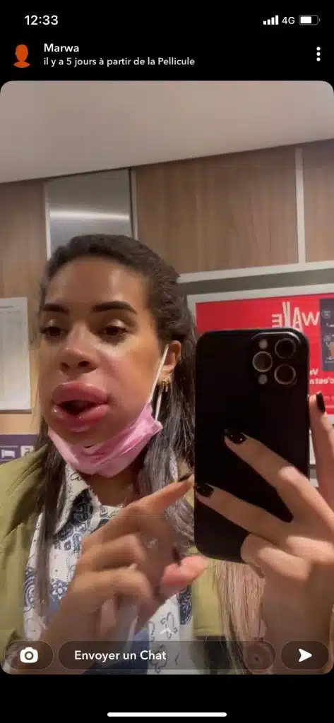 Marwa Merazka